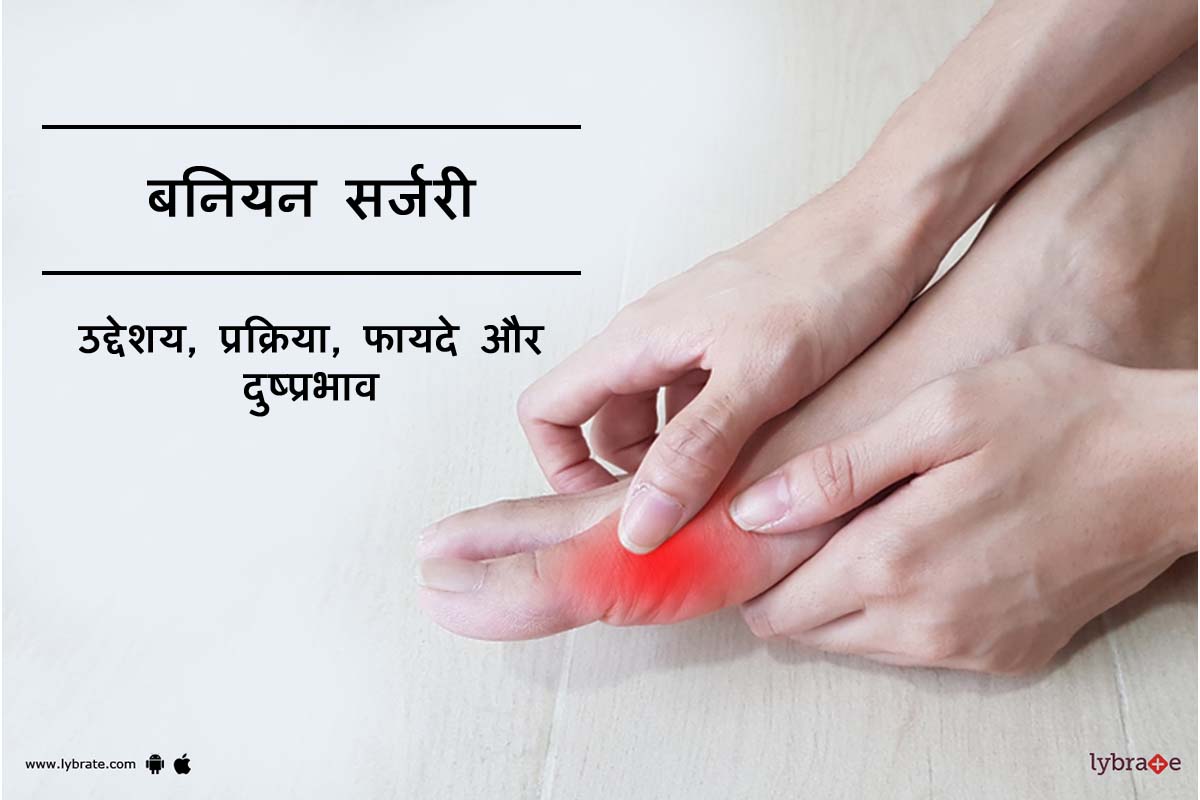 बनियन सर्जरी क्या है?