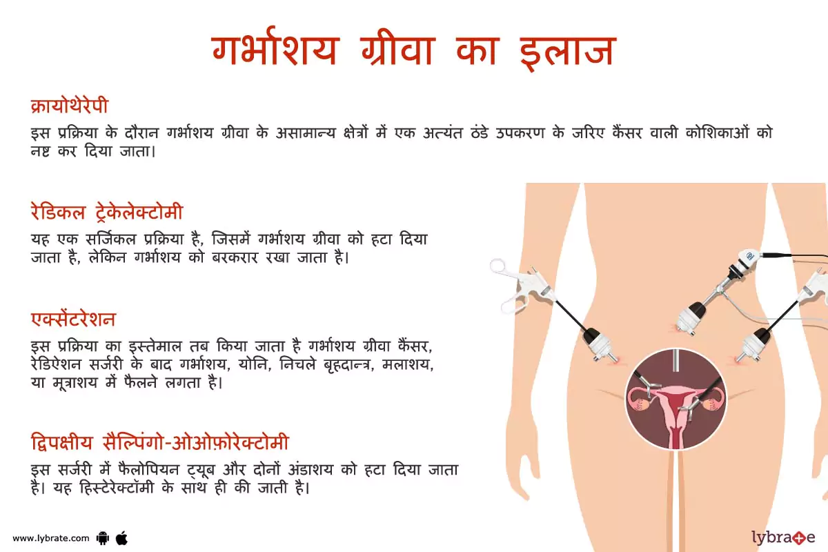 गर्भाशय ग्रीवा(सर्विक्स) का इलाज | Cervix Ki Bimariyon Ke Ilaaj