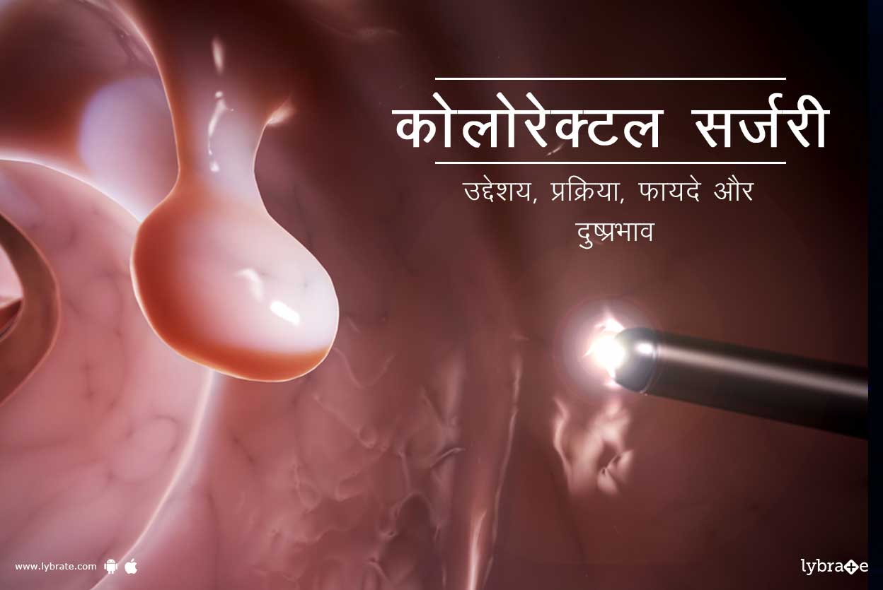 कोलोरेक्टल सर्जरी क्या है?