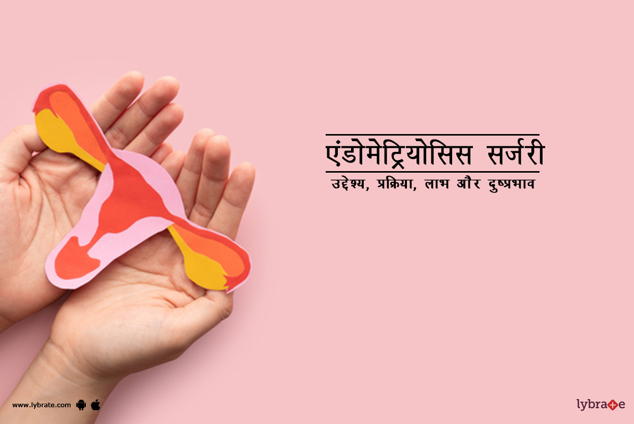 एंडोमेट्रियोसिस सर्जरी क्या है?