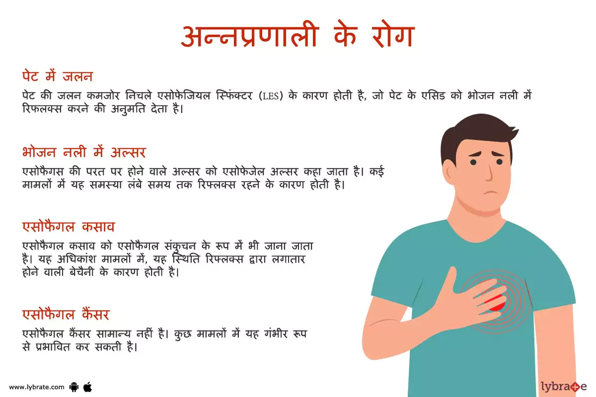 एसोफैगस(अन्नप्रणाली) के रोग | Esophagus Ki Bimariya