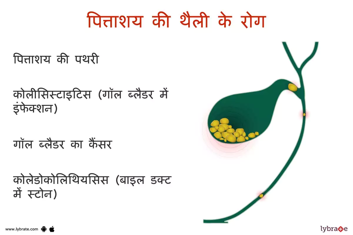 गॉलब्लेडर के रोग | Gallbladder Ki Bimariya