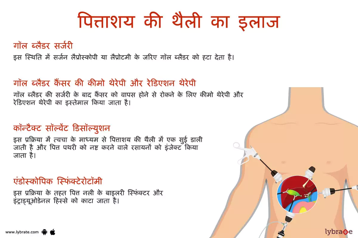 गॉलब्लेडर का इलाज | Gallbladder Ki Bimariyon Ke Ilaaj
