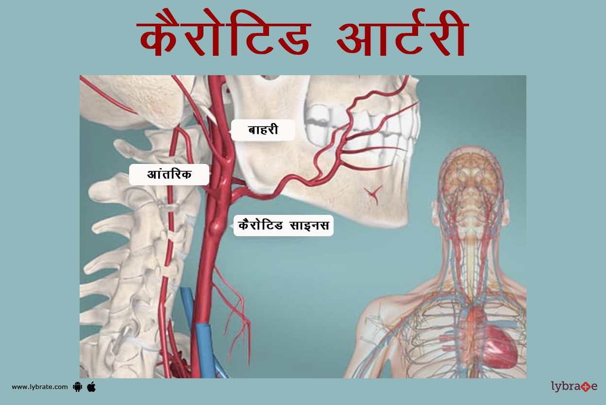 कैरोटिड आर्टरी(ग्रीवा धमनी) का चित्र | Carotid Artery Ki Image