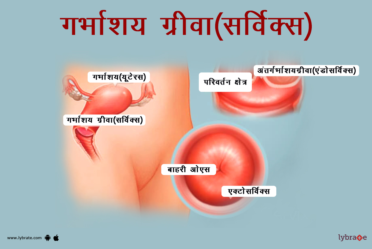 गर्भाशय ग्रीवा(सर्विक्स) का चित्र | Cervix Ki Image