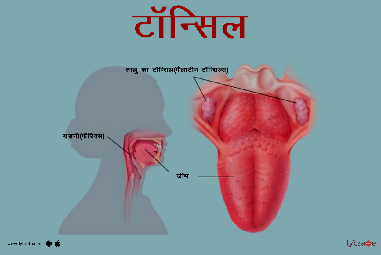 टॉन्सिल्स का चित्र | Tonsils Ki Image