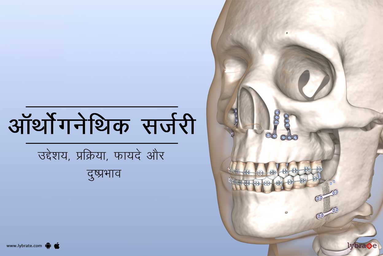ऑर्थोग्नेथिक सर्जरी क्या है?
