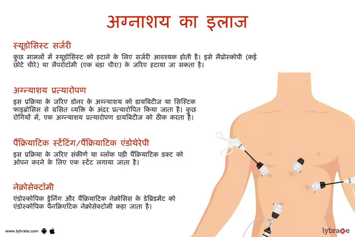 अग्न्याशय(पैंक्रियास) का इलाज | Pancreas Ki Bimariyon Ke Ilaaj