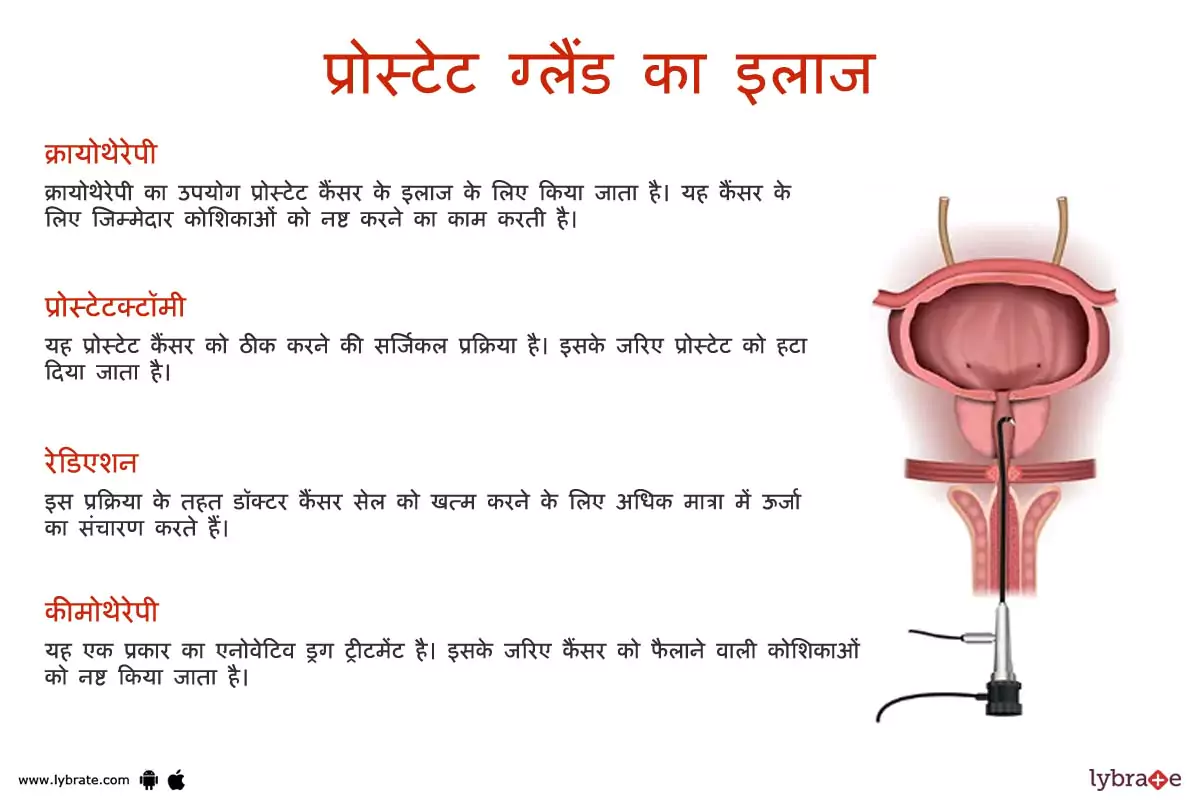 प्रोस्टेट का इलाज | Prostate Ki Bimariyon Ke Ilaaj