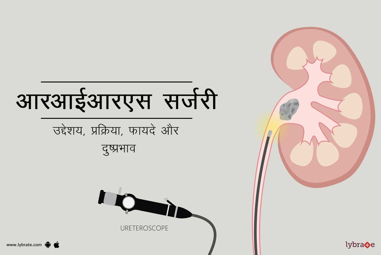 आरआईआरएस सर्जरी क्या है?