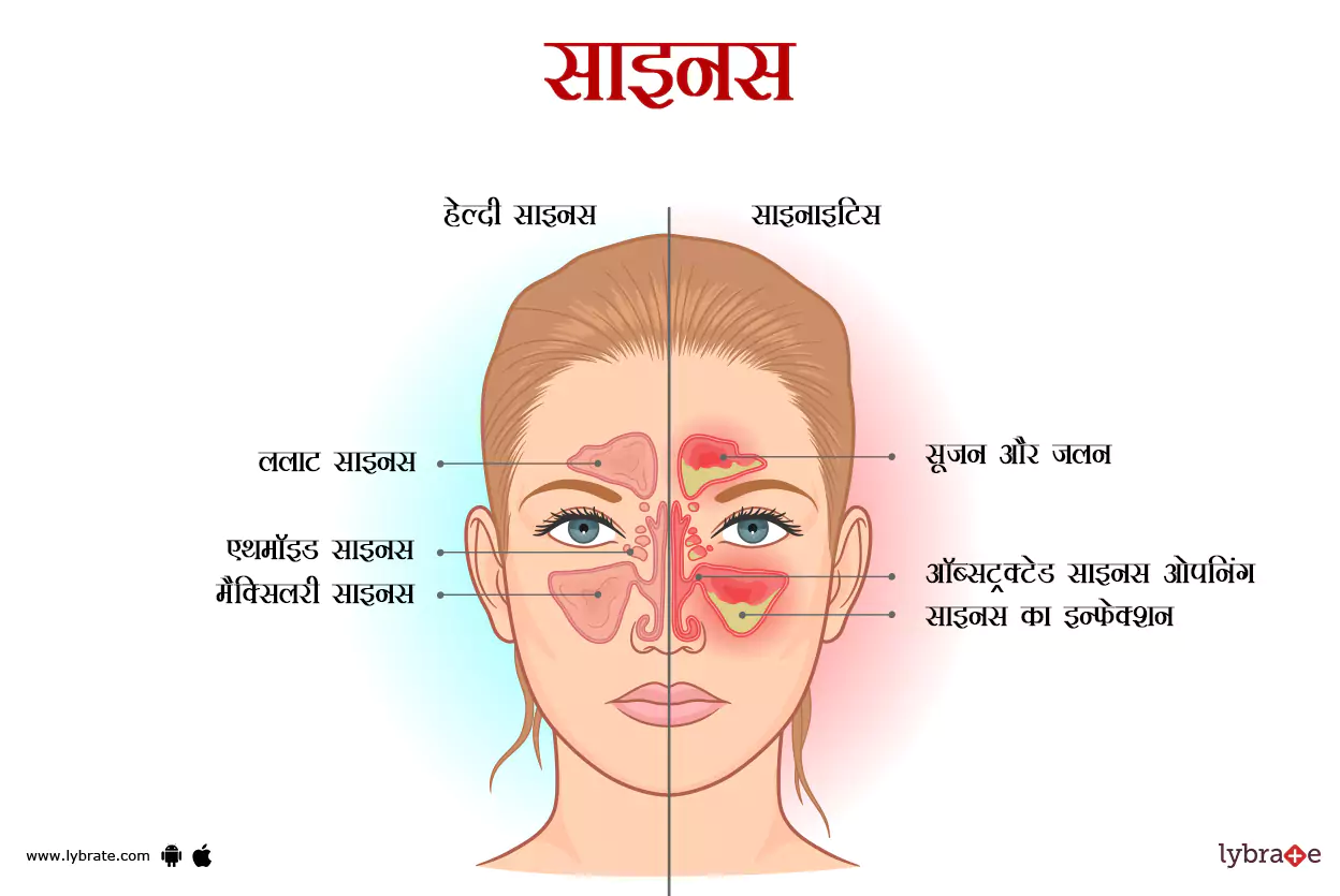 साइनस का चित्र | Sinus Ki Image