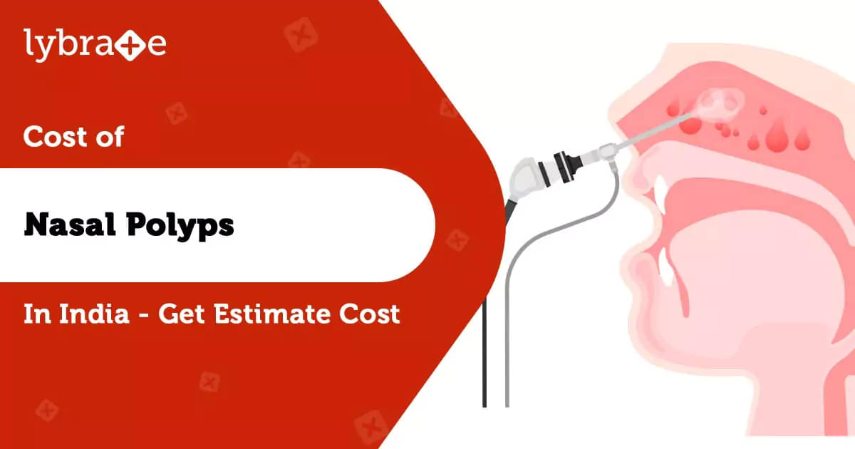 Nasal Polyps Surgery Cost in India- Lowest Cost Estimate
