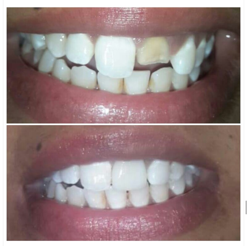 De Cure - A Multispeciality Clinic For Dental & Physiotherapy Image 7