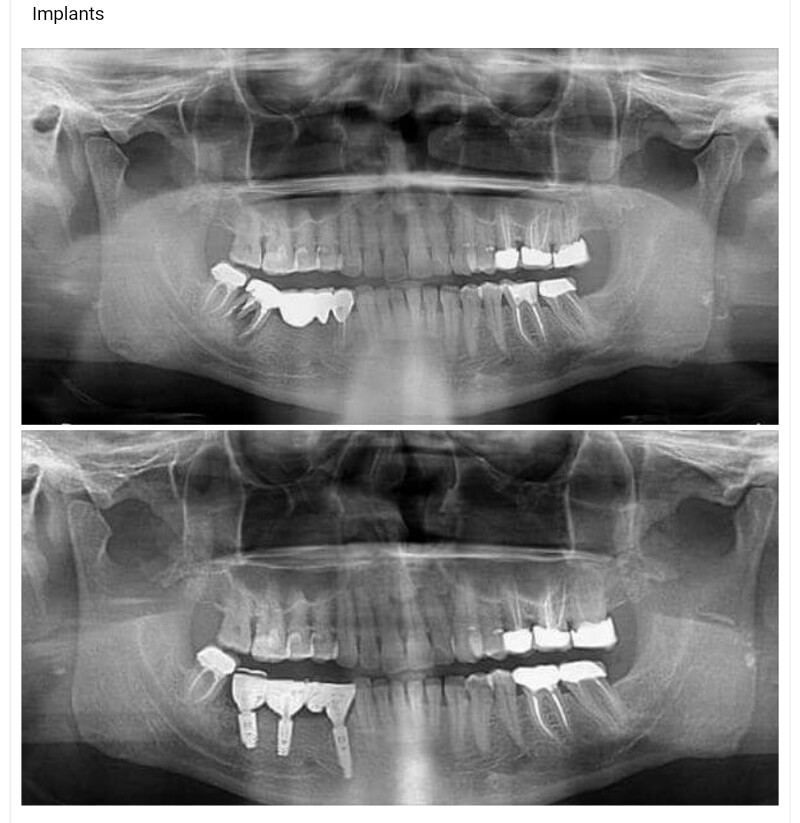 De Cure - A Multispeciality Clinic For Dental & Physiotherapy Image 6
