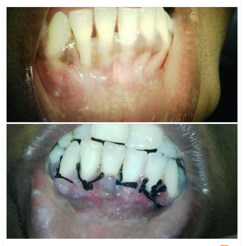 De Cure - A Multispeciality Clinic For Dental & Physiotherapy Image 9