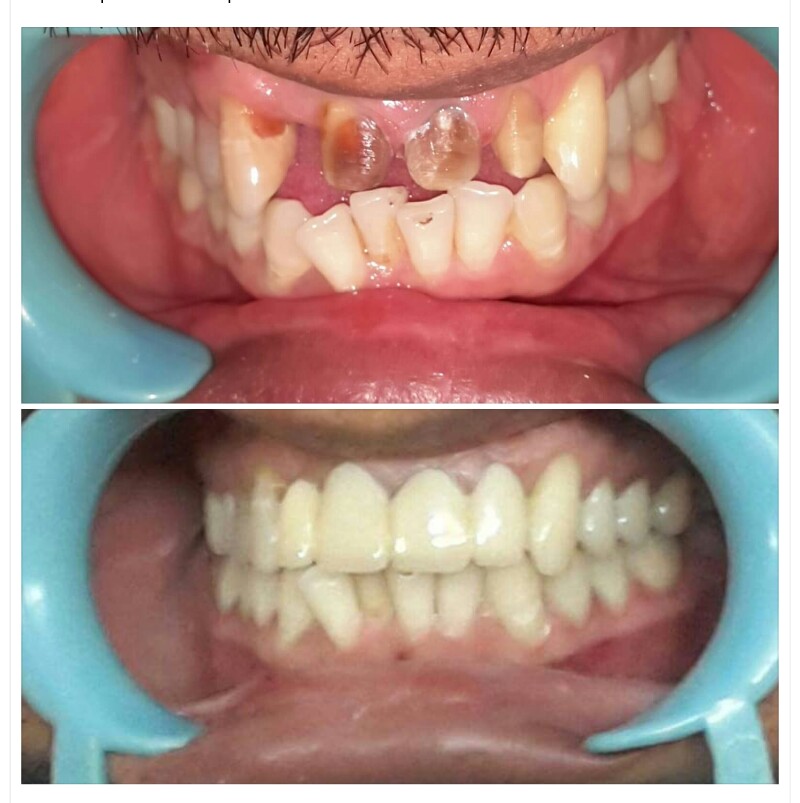 De Cure - A Multispeciality Clinic For Dental & Physiotherapy Image 10