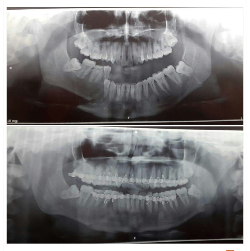 De Cure - A Multispeciality Clinic For Dental & Physiotherapy Image 8