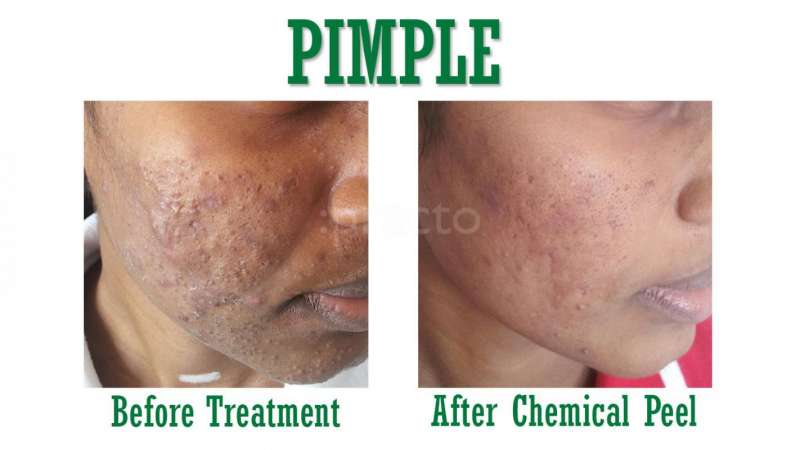 Sree Skin Hair & Cosmetic Clinic Image 4