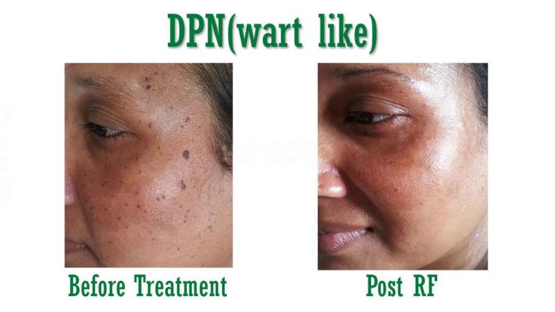 Sree Skin Hair & Cosmetic Clinic Image 1