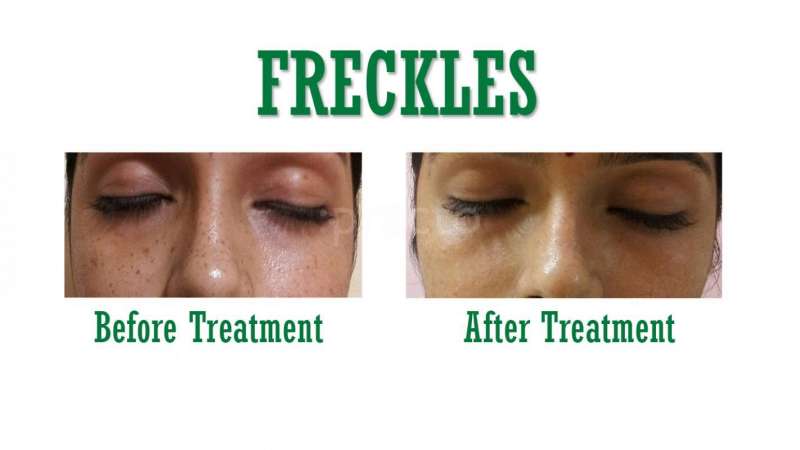 Sree Skin Hair & Cosmetic Clinic Image 3