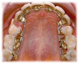 Dr.Pradhan's Smile Solutions Dental Clinic Image 2