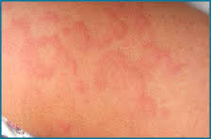 Allergy And Asthma Clinic Image 1