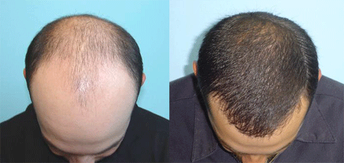 APEX PLASTIC & COSMETIC SURGERY CENTER Image 1