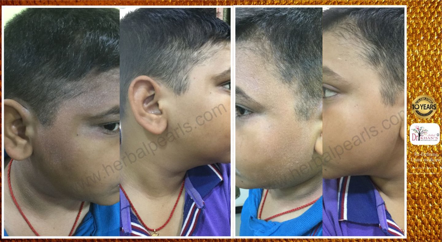 Dr Khan's Skin Clinic Image 10