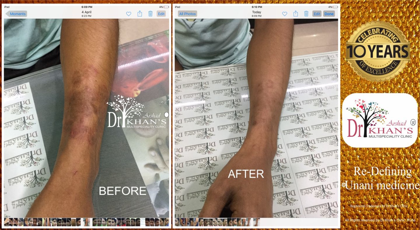 Dr Khan's Skin Clinic Image 6