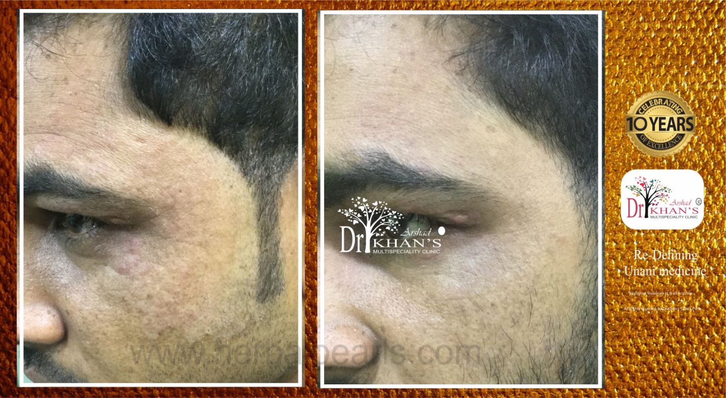 Dr Khan's Skin Clinic Image 7