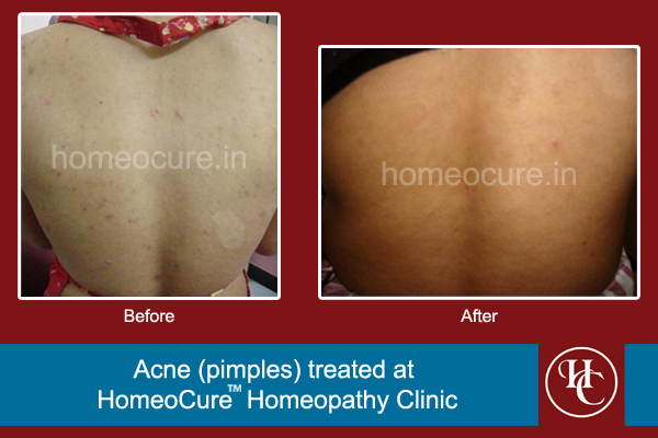 HomeoCure™ Homeopathy Clinic, Tilak Road Image 9