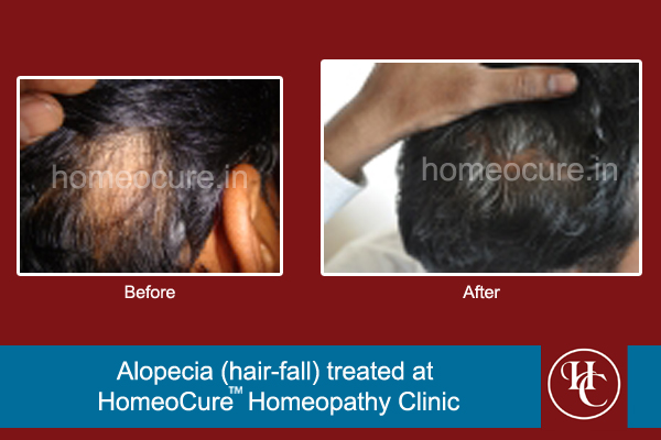 HomeoCure™ Homeopathy Clinic, Tilak Road Image 8