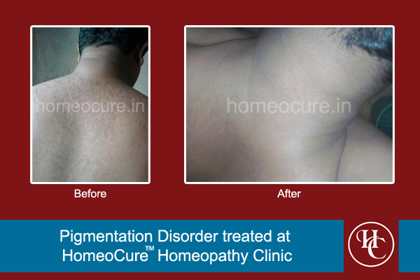 HomeoCure™ Homeopathy Clinic, Tilak Road Image 6