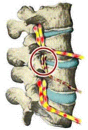 Ortho Neuro Chiropractic Physiotherapy Clinic Image 10