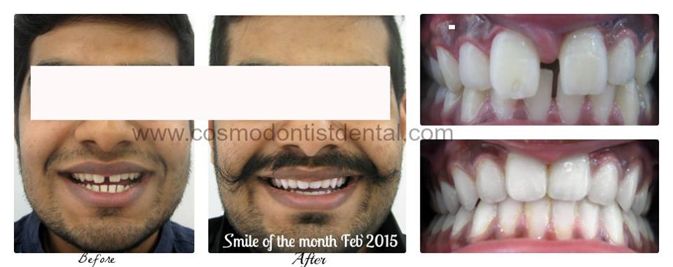 Cosmodontist Dental & Implant Centre Image 2