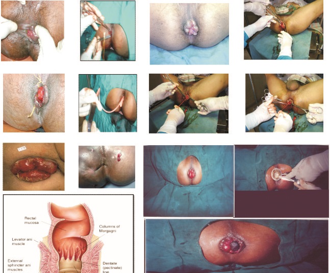 Dhanwantari Ayurved Ksharasutra & Panchakarma Clinic Image 2