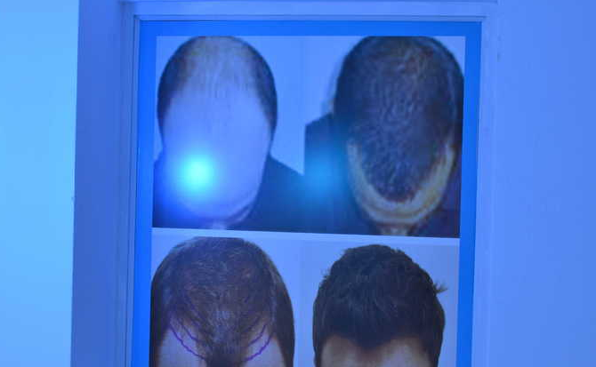 Dr. Partha Sarathi's Asian Hair & Skin Hospitals Image 1