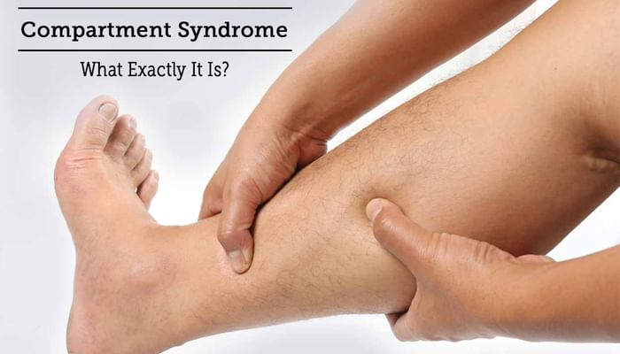 Compartment Syndrome - What Exactly It Is?