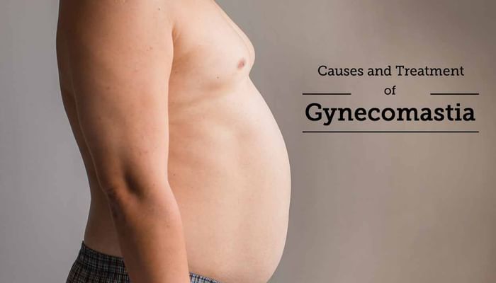 Causes and Treatment of Gynecomastia