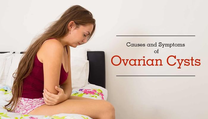 Causes and Symptoms of Ovarian Cysts