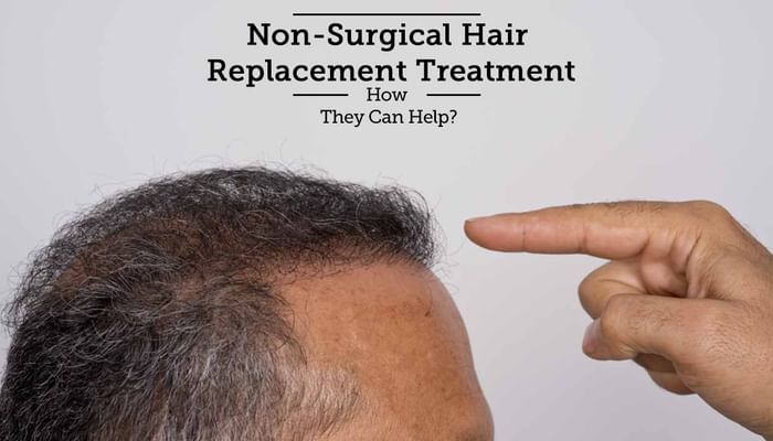 Non-Surgical Hair Replacement Treatment - How They Can Help?