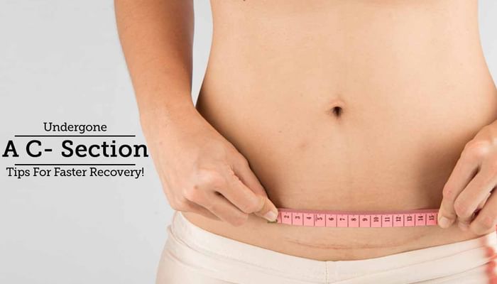 C-Section - Tips To Help You Recover Quickly!