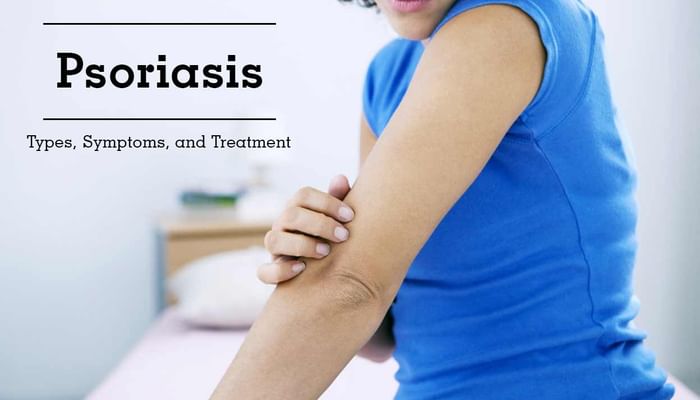 Psoriasis - Types, Symptoms, and Treatment