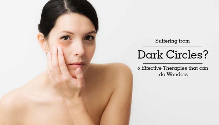 Suffering from Dark Circles? 5 Effective Therapies that can do Wonders
