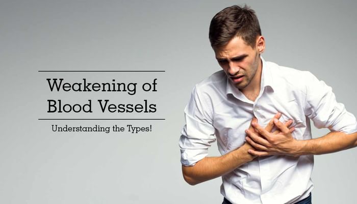 Weakening of Blood Vessels - Understanding the Types!