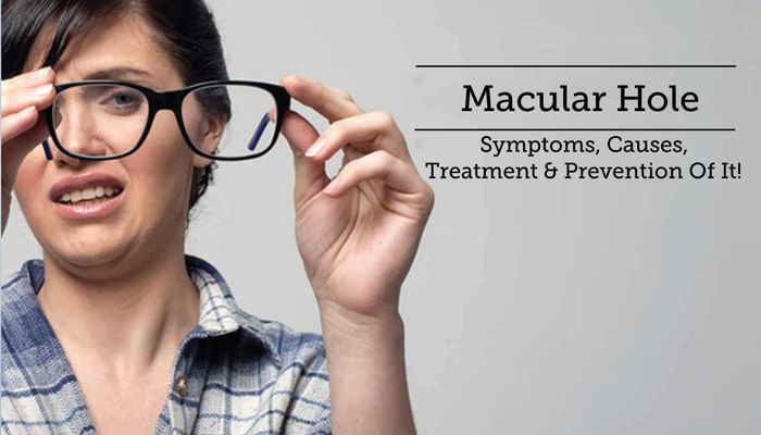 Macular Hole - Symptoms, Causes, Treatment & Prevention Of It!