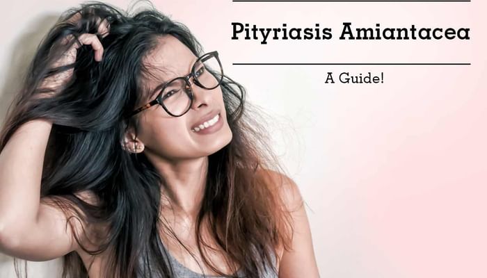 Pityriasis Amiantacea - A Guide!