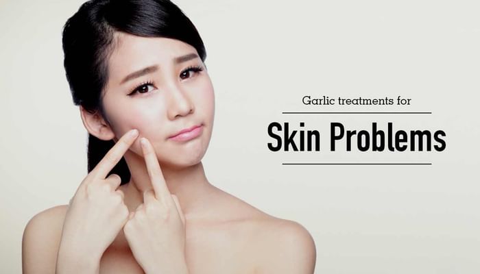 Garlic Treatments For Skin Problems