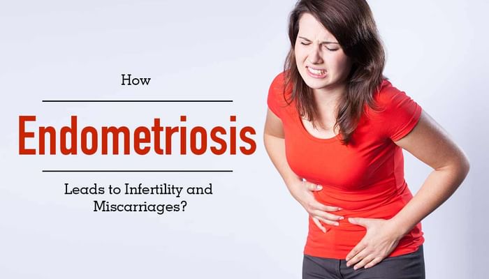 How Endometriosis Leads to Infertility and Miscarriages?