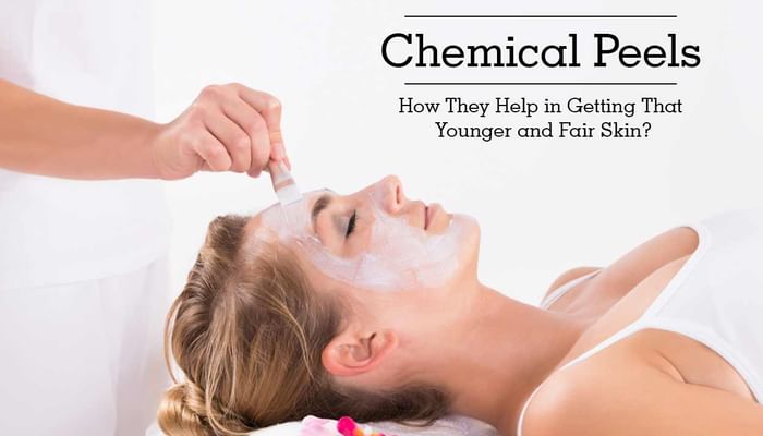 Chemical Peels - How They Help in Getting That Younger and Fair Skin?